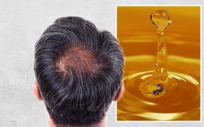Propoli e miele possono prevenire la caduta dei capelli?