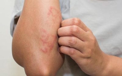 I benefici della cera d’api per la nostra pelle